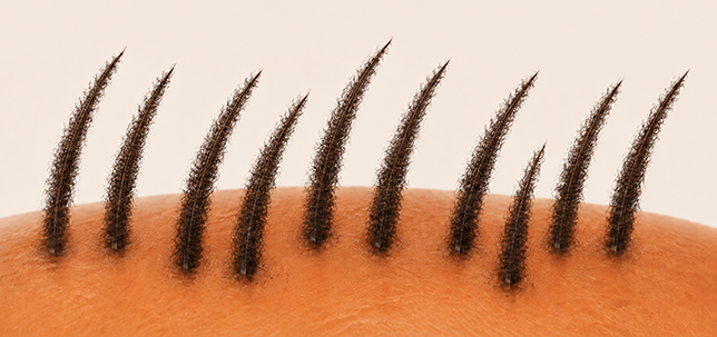Gli stessi capelli, più folti e voluminosi dopo aver applicato Caboki