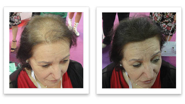 Prima e dopo l'uso di Caboki 30 g — foto del risultato del cliente stesso