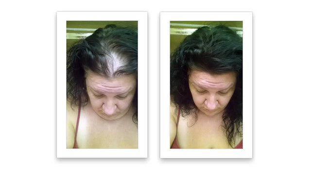 Prima e dopo l'uso di Caboki 30 g — foto del risultato del cliente stesso