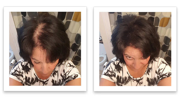 Prima e dopo l'uso di Caboki 30 g — foto del risultato del cliente stesso