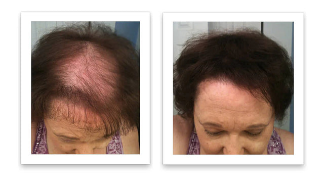 Prima e dopo l'uso di Caboki 30 g — foto del risultato del cliente stesso